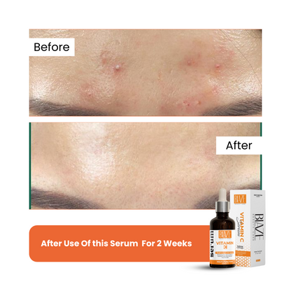 Vitamin C Brightening | Hydrating Serum