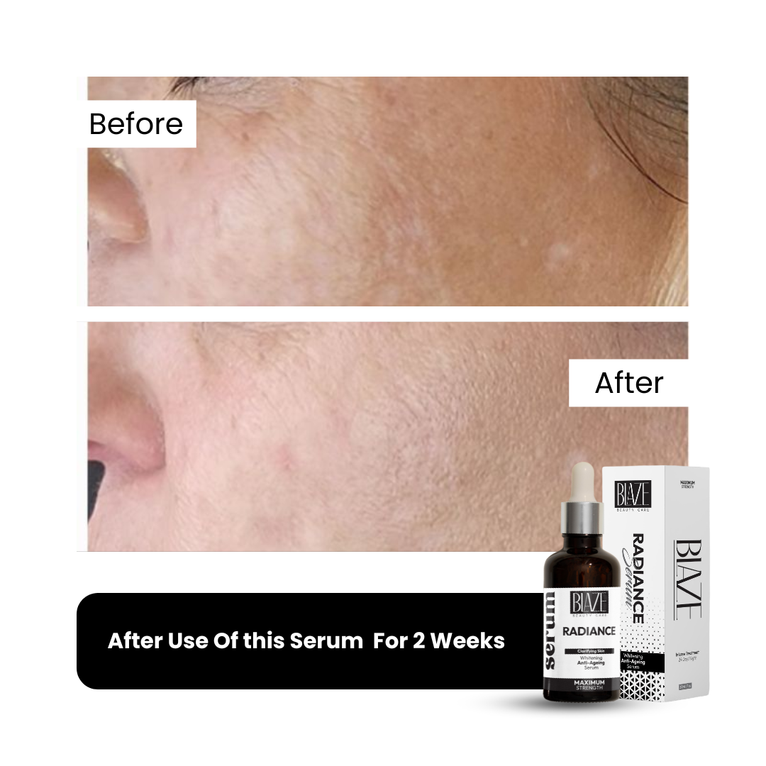 RADIANCE | Skin Whitening Serum